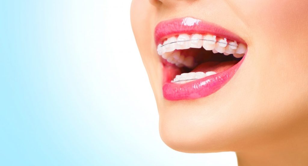 Tips For Invisalign Doctor Login